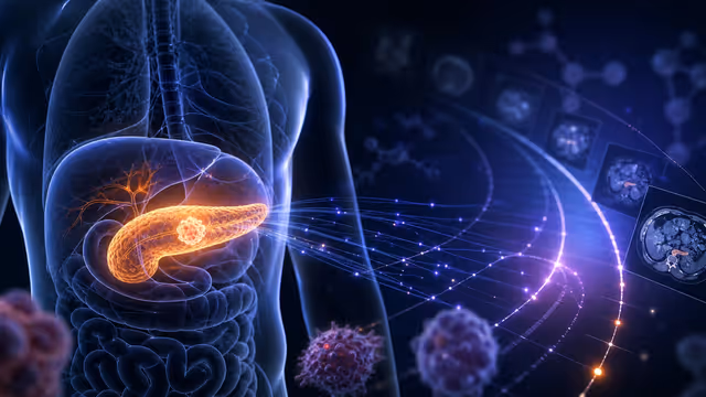 Imagem: AI da Mayo Clinic Detecta Câncer de Pâncreas Anos Antes do Diagnóstico